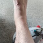 4 Weeks After Damage